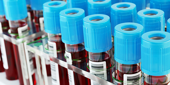 Blood test tubes. Blood samples in a rack.